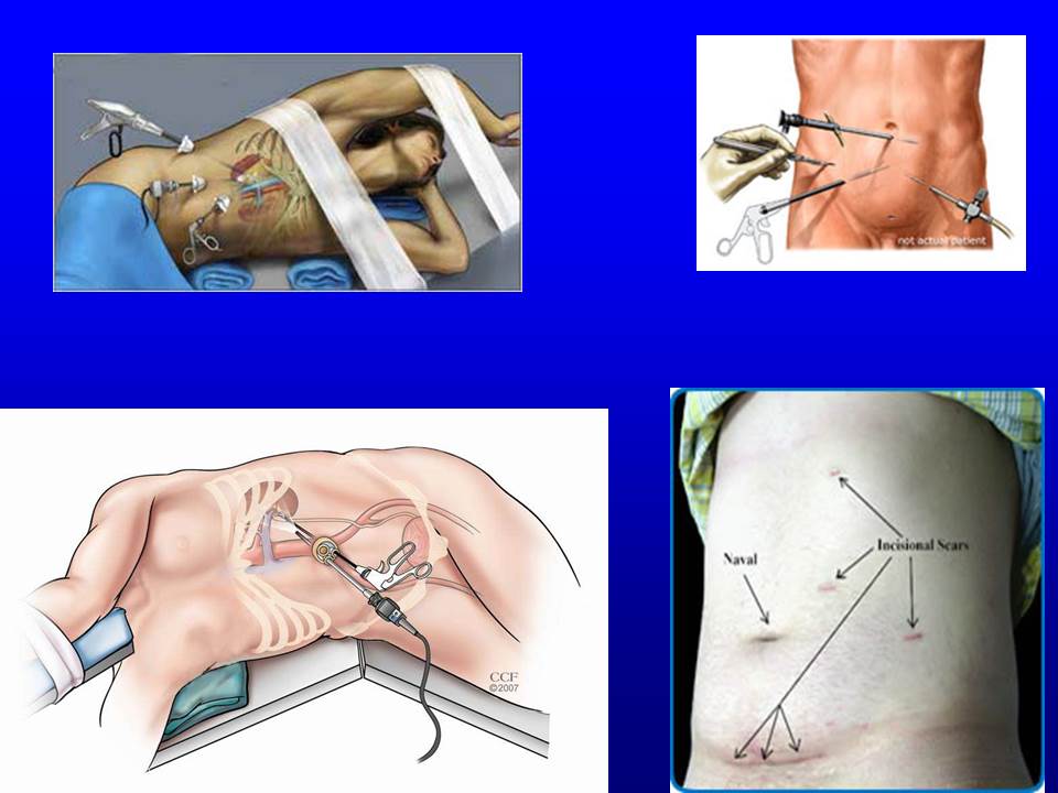 hoden massieren paderborn sex hoden massieren paderborn sex